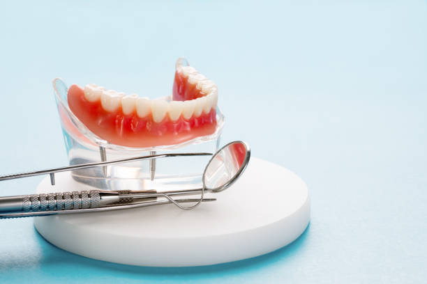 Laser Dentistry in California, MD